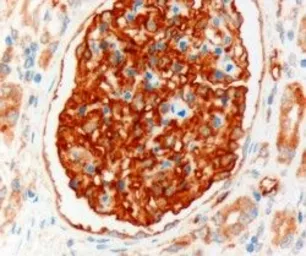 Anti-NHERF2 (isoform a) antibody, Internal used in IHC (Paraffin sections) (IHC-P). GTX89452