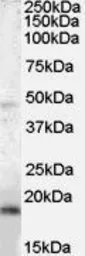Anti-BAALC antibody, Internal used in Western Blot (WB). GTX89453