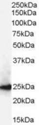 Anti-CBX1 / HP1 beta antibody, Internal used in Western Blot (WB). GTX89455