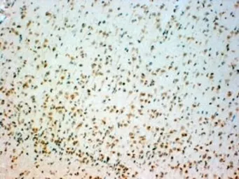 Anti-TPH2 antibody, Internal used in IHC (Paraffin sections) (IHC-P). GTX89459