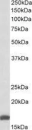 Anti-RPS19 antibody, Internal used in Western Blot (WB). GTX89461