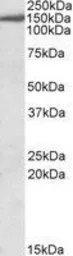 Anti-EPB41L3 antibody, C-term used in Western Blot (WB). GTX89463