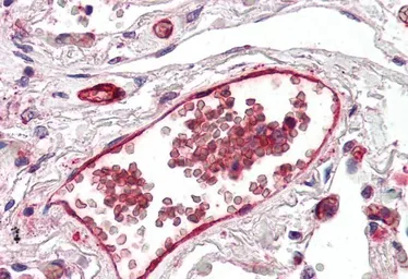 Anti-DARC antibody, N-term used in IHC (Paraffin sections) (IHC-P). GTX89467