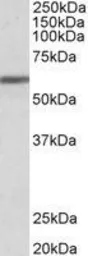 Anti-ZNF703 antibody, Internal used in Western Blot (WB). GTX89468