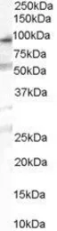 Anti-OSBPL10 antibody, Internal used in Western Blot (WB). GTX89470