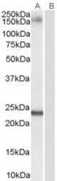 Anti-GOLGA3 antibody, C-term used in Western Blot (WB). GTX89474