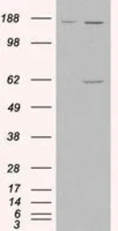 Anti-Monoamine Oxidase A antibody, Internal used in Western Blot (WB). GTX89475