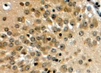 Anti-NOTCH3 antibody, C-term used in IHC (Paraffin sections) (IHC-P). GTX89476