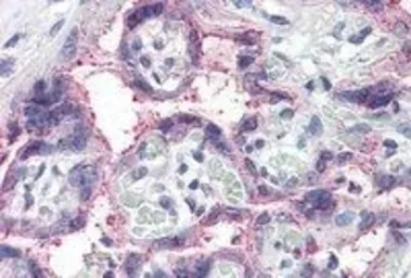 Anti-NOTCH3 antibody, C-term used in IHC (Paraffin sections) (IHC-P). GTX89476