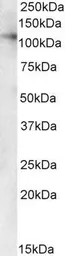 Anti-VDP / p115 antibody, C-term used in Western Blot (WB). GTX89480