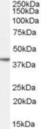 Anti-Nanog antibody, Internal used in Western Blot (WB). GTX89490
