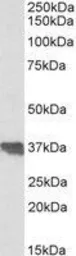 Anti-Clusterin antibody, C-term used in Western Blot (WB). GTX89492