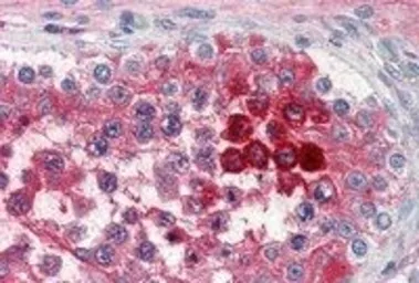 Anti-Clusterin antibody, C-term used in IHC (Paraffin sections) (IHC-P). GTX89492