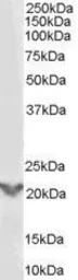 Anti-TGF beta induced factor 2 antibody, Internal used in Western Blot (WB). GTX89501