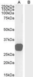 Anti-GDF15 antibody, C-term used in Western Blot (WB). GTX89503