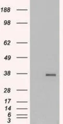 Anti-GDF15 antibody, C-term used in Western Blot (WB). GTX89503