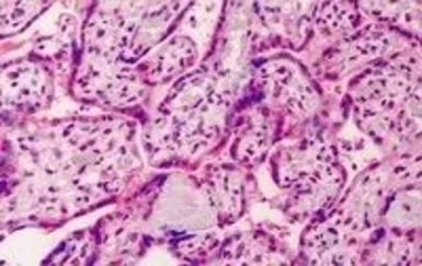 Anti-GDF15 antibody, C-term used in IHC (Paraffin sections) (IHC-P). GTX89503