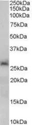 Anti-SIRT3 antibody, C-term used in Western Blot (WB). GTX89507