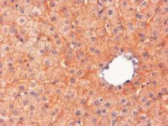 Anti-ENPP1 antibody, C-term used in IHC (Paraffin sections) (IHC-P). GTX89508