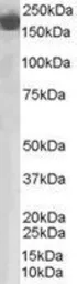 Anti-Factor H antibody, Internal used in Western Blot (WB). GTX89512