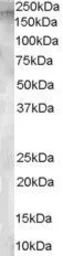 Anti-Aminopeptidase A antibody, Internal used in Western Blot (WB). GTX89515