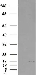 Anti-SH2D1A antibody, Internal used in Western Blot (WB). GTX89516