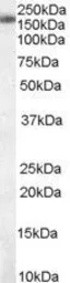 Anti-SART3 antibody, C-term used in Western Blot (WB). GTX89518