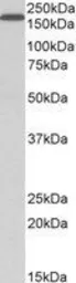 Anti-LRP5 antibody, Internal used in Western Blot (WB). GTX89521