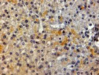 Anti-LRP5 antibody, Internal used in IHC (Paraffin sections) (IHC-P). GTX89521