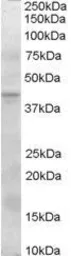 Anti-SERPINI2 antibody, Internal used in Western Blot (WB). GTX89529