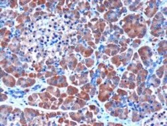 Anti-SERPINI2 antibody, Internal used in IHC (Paraffin sections) (IHC-P). GTX89529