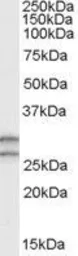 Anti-COMT antibody, N-term used in Western Blot (WB). GTX89530