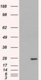 Anti-GSTP1 antibody, Internal used in Western Blot (WB). GTX89536