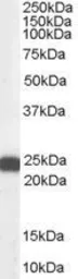 Anti-BAG2 antibody, C-term used in Western Blot (WB). GTX89538