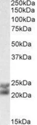 Anti-Caveolin 1 antibody, Internal used in Western Blot (WB). GTX89541