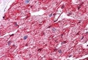 Anti-Caveolin 1 antibody, Internal used in IHC (Paraffin sections) (IHC-P). GTX89541