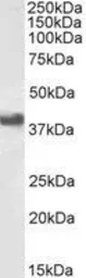Anti-CD32B antibody, C-term used in Western Blot (WB). GTX89542