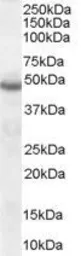 Anti-Neuroserpin antibody, C-term used in Western Blot (WB). GTX89544