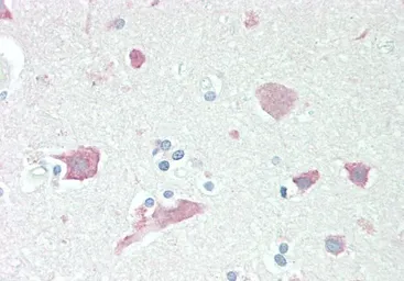 Anti-Neuroserpin antibody, C-term used in IHC (Paraffin sections) (IHC-P). GTX89544