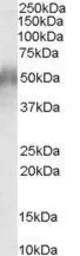 Anti-CD2BP2 antibody, N-term used in Western Blot (WB). GTX89547