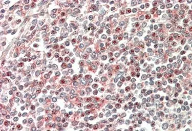 Anti-CD2BP2 antibody, N-term used in IHC (Paraffin sections) (IHC-P). GTX89547