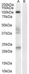 Anti-Nogo Receptor antibody, Internal used in Western Blot (WB). GTX89548