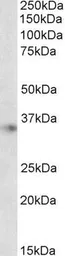 Anti-Apolipoprotein E antibody, C-term used in Western Blot (WB). GTX89549