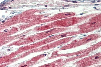 Anti-IRAK4 antibody, N-term used in IHC (Paraffin sections) (IHC-P). GTX89550