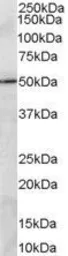 Anti-PRDM11 antibody, C-term used in Western Blot (WB). GTX89551
