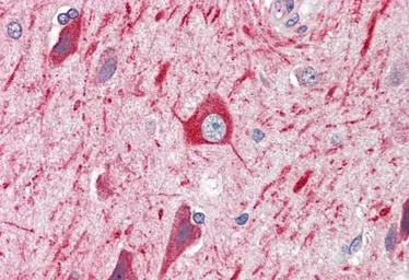 Anti-PRDM11 antibody, C-term used in IHC (Paraffin sections) (IHC-P). GTX89551