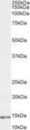 Anti-Parvalbumin antibody, C-term used in Western Blot (WB). GTX89558