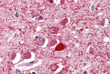 Anti-Parvalbumin antibody, C-term used in IHC (Paraffin sections) (IHC-P). GTX89558