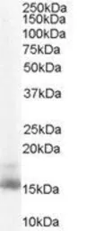 Anti-RBP1 antibody, C-term used in Western Blot (WB). GTX89561