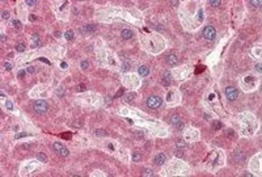 Anti-RBP1 antibody, C-term used in IHC (Paraffin sections) (IHC-P). GTX89561